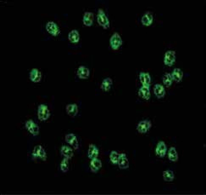 Přítomnost c-ANCA protilátek (cytoplazmatická reakce) na etanolem fixovaných neutrofilních granulocytech.