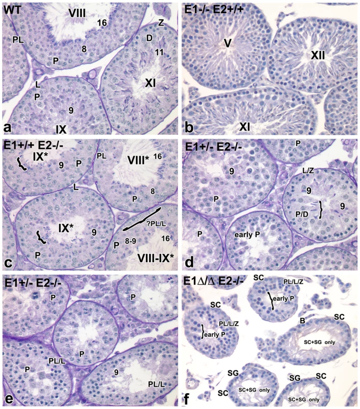 Additional E-type cyclin deficiency causes progressive loss of advanced spermatogenic cells.