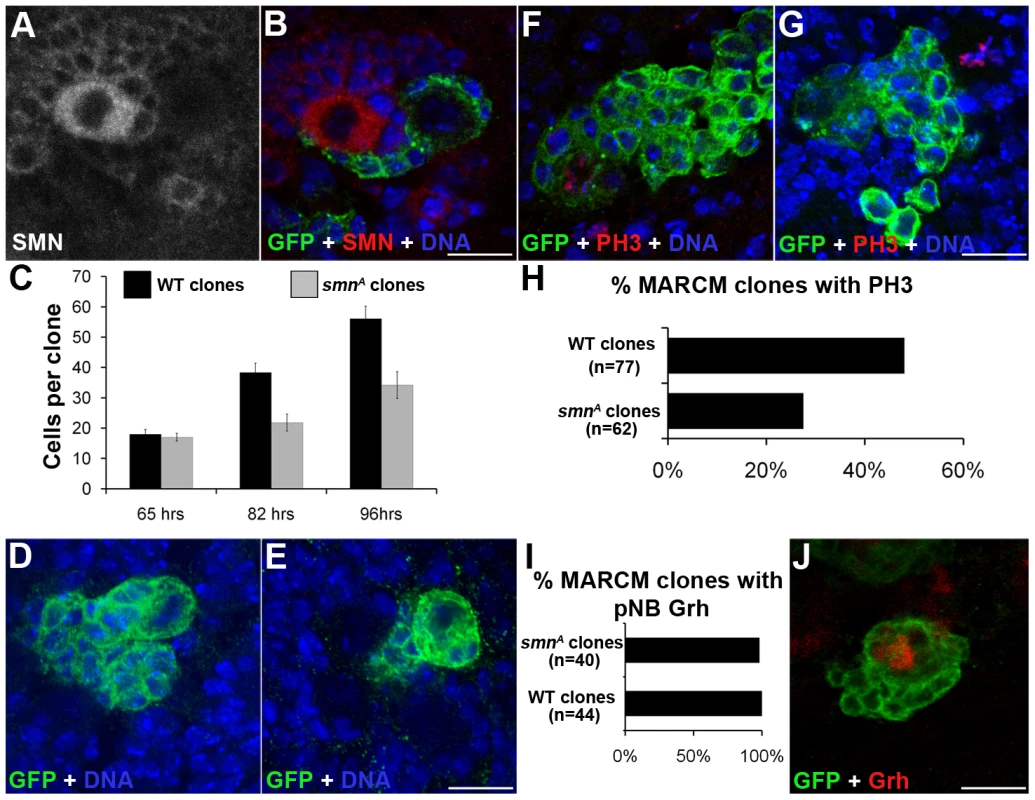 MARCM analysis of SMN in the larval CNS.