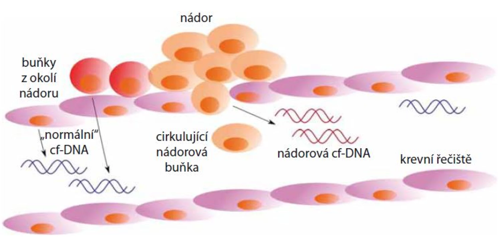 Uvolňování cf-DNA nekrózou z nádorových buněk do krevního řečiště. Do krevního oběhu je také uvolňována cf-DNA z buněk v okolí nádoru.