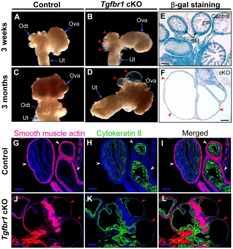 Oviductal diverticula development in <i>Tgfbr1</i> cKO mice.