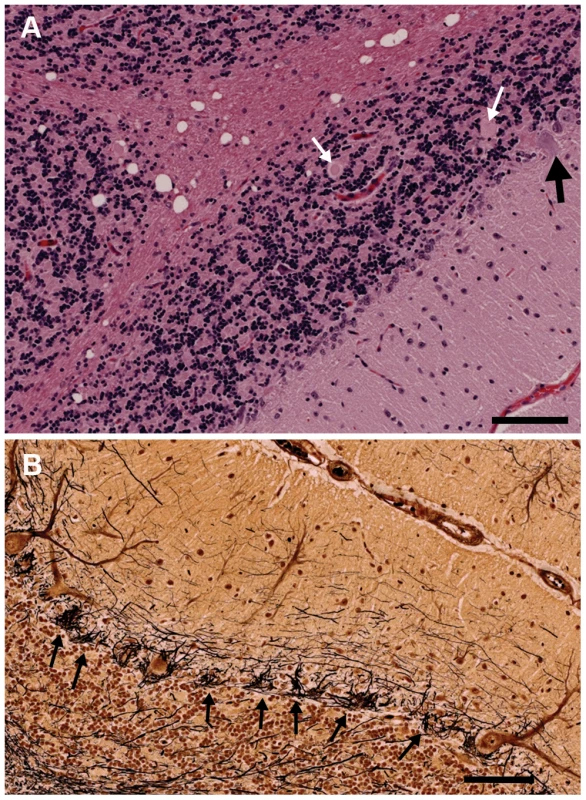 Sections of the cerebellum from an affected 2.5-year-old Gordon Setter stained with hematoxylin and eosin (a) and Bielschowsky (b).