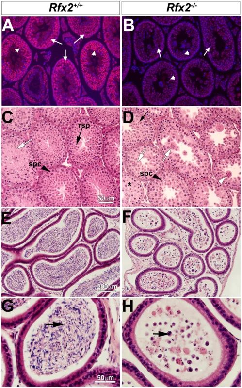 Spermatogenesis is arrested in <i>Rfx2</i><sup><i>-/-</i></sup> mice.