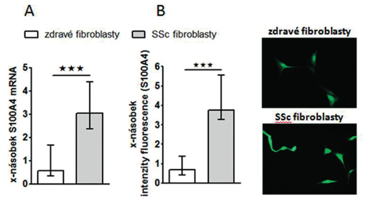 Exprese S100A4 je zvýšená v SSc fibroblastech