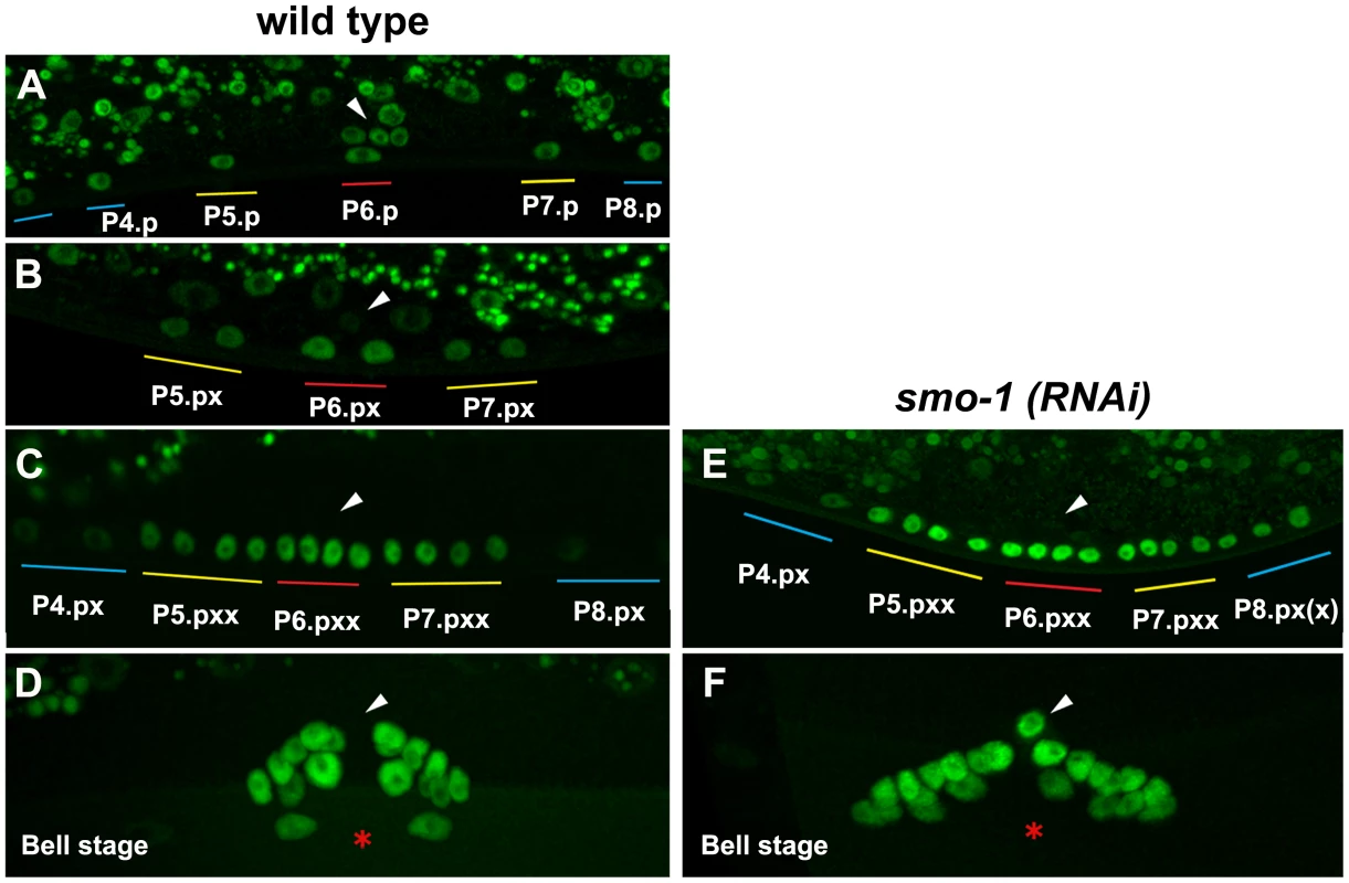 NHR-25::GFP (OP33) expression during vulval development.