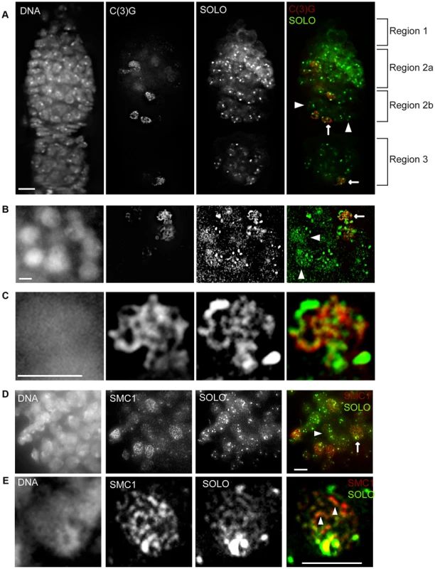 SOLO co-aligns with C(3)G and SMC1 on chromosome arms in pro-oocytes and oocytes.
