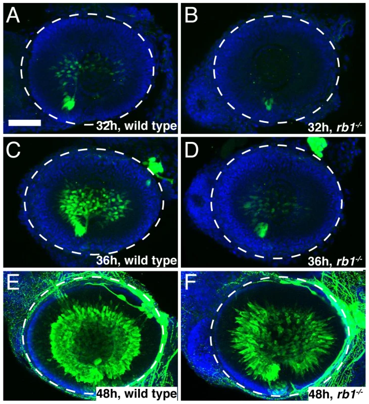 <i>rb1<sup>te226a</sup></i> retinas possess fewer postmitotic RGCs.