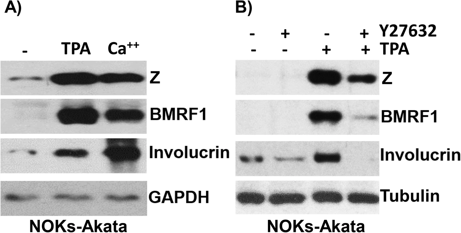 Treatment of NOKs-Akata cells with the differentiating agents, TPA and calcium chloride/serum, results in lytic EBV reactivation.