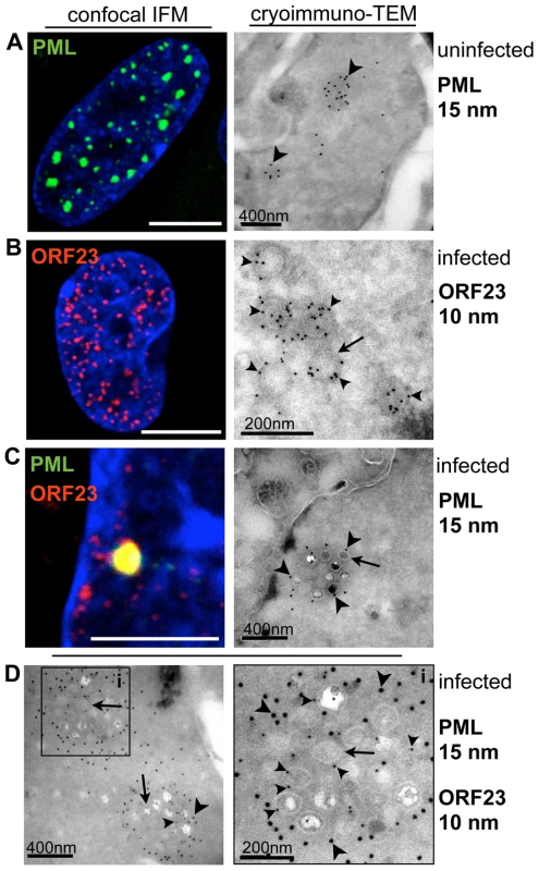 VZV nucleocapsids are sequestered in endogenous nuclear PML cages.