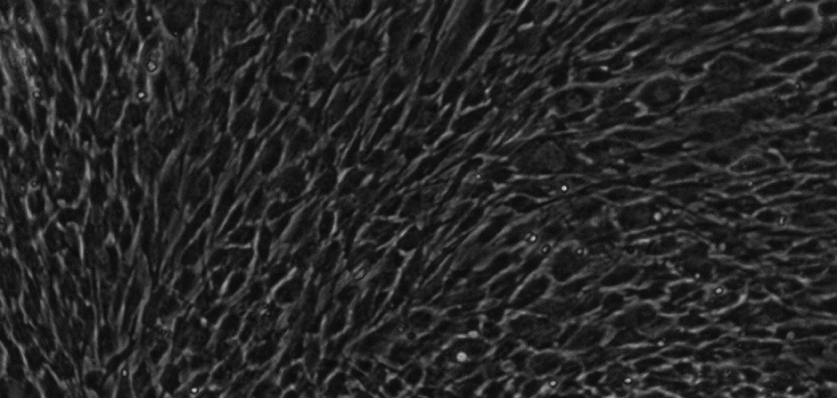 Kmenové buňky zubní pulpy izolované ze subodontoblastického kompartmentu při 30. pasáži. Buňky jsou více okrouhlé. KBZP mají v průměru 12 - 18 μm.Mikroskop s fázovým kontrastem, zvětšení 200x.