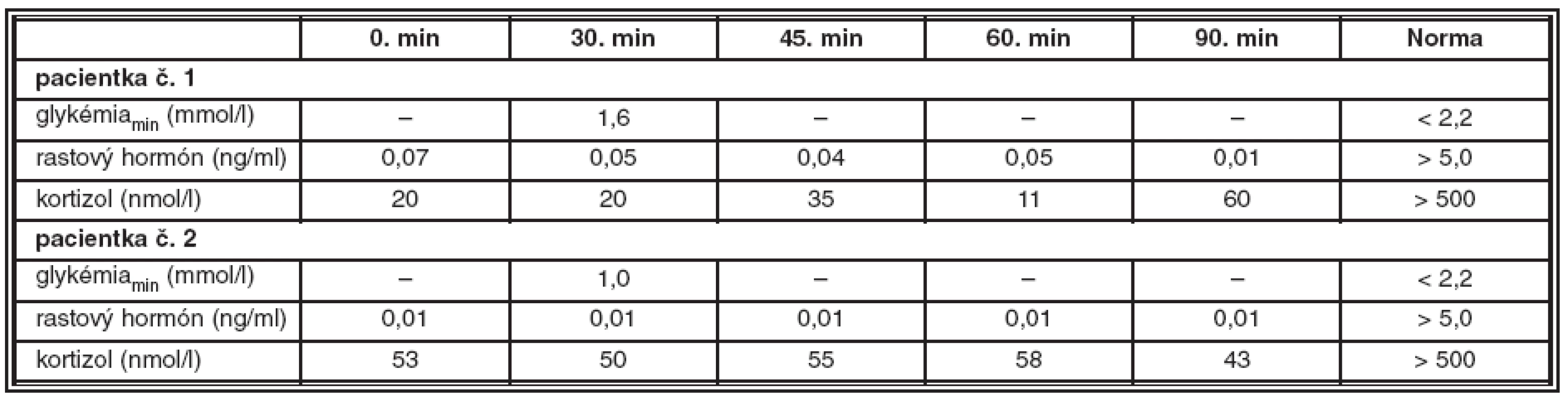 Výsledky stimulačných testov s postinzulínovou hypoglykémiou u pacientky č. 1 a pacientky č. 2