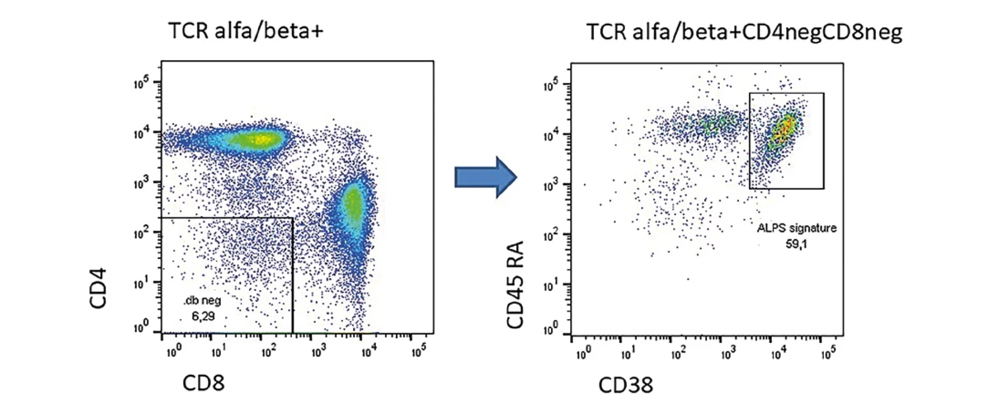 Příklad pacienta s prokázanou heterozygotní mutací v genu Fas s projevy lymfoproliferace a splenomegaliÍ. U pacienta zřetelně zvýšené TCR alfa/beta dvojitě negativní T lymfocyty a zřetelným tzv. ALPS signature.