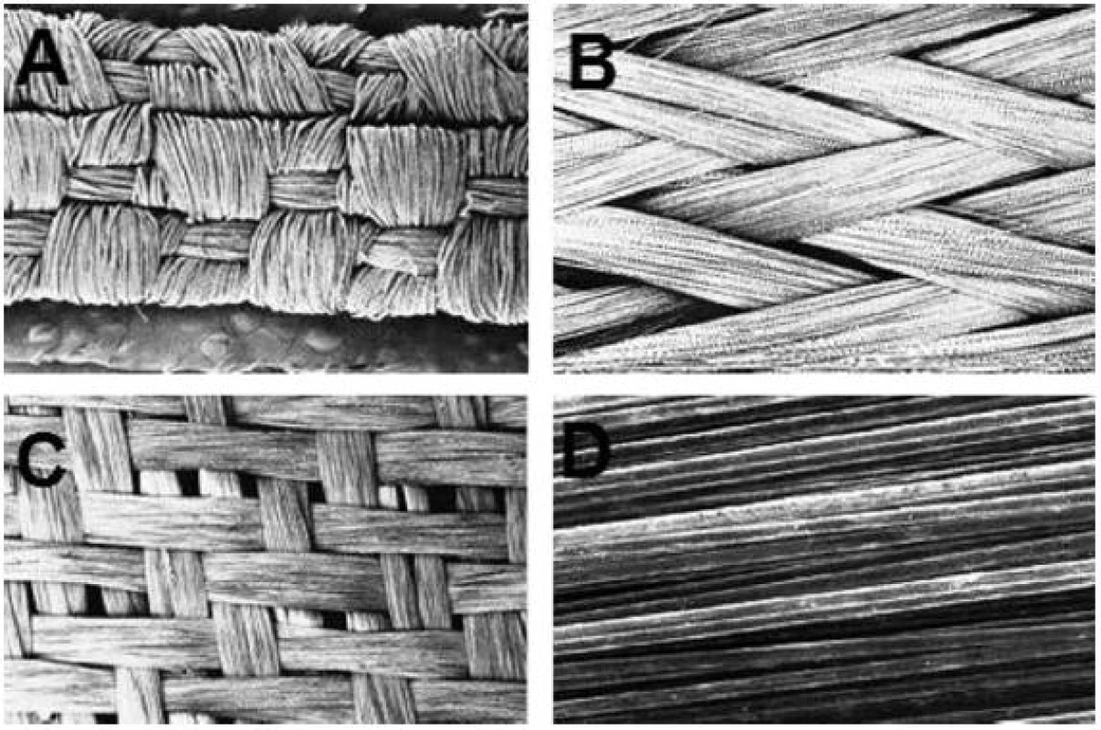 Uspořádání vláken v FRC v rastrovacím elektronovém mikroskopu – tkaná polyetylenová vlákna (a), pletená skelná vlákna (b), tkaná skelná vlákna (c) a jednosměrně uspořádaná vlákna (d); převzato z Fiber-reinforced composite in clinical dentistry, Chicago: Quintessence; 2000