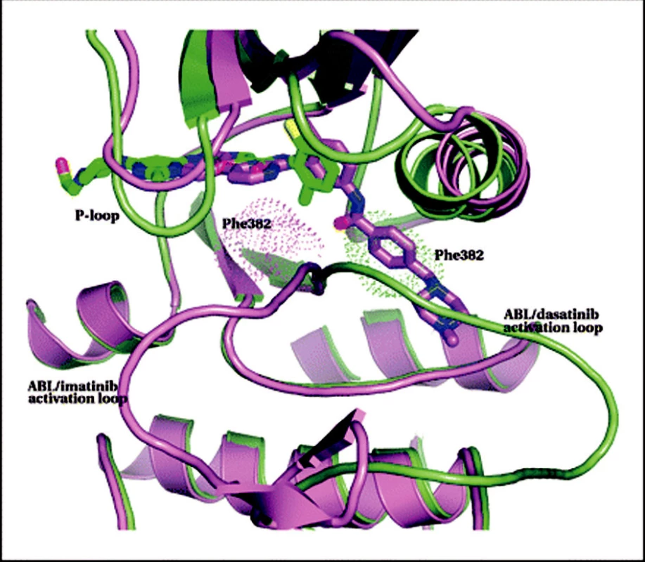 Srovnání vazby dasatinibu a imatinibu na BCR-ABL kinázu.
Protein a dasatinib jsou zeleně, zároveň je ukázána struktura imatinibu s odpovídající proteinovou částí ve fialové barvě. Speciálně označeny jsou aktivační smyčky. Za pozornost stojí rozdílné polohy těchto smyček při vazbě obou molekul a také to, že obě molekuly sice částečně okupují stejné místo, jinak ale míří na opačné strany. Speciálně je zvýrazněn Phe382 aktivační smyčky a je vidět, že imatinib (na rozdíl od dasatinibu) se nemůže vázat na smyčku v aktivované poloze, neboť tam pro něj není místo. Upraveno dle Tokarski et al. (39).