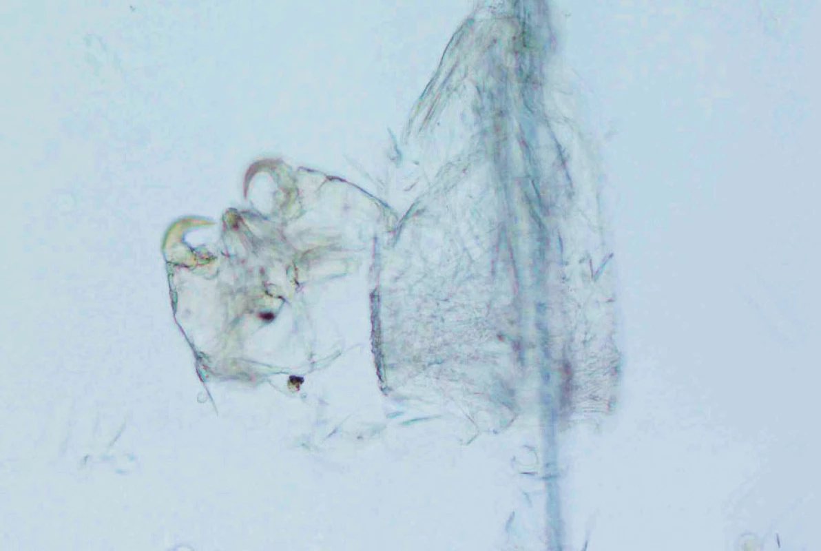 Cheyletiella – část těla s makadly a prázdná hnida