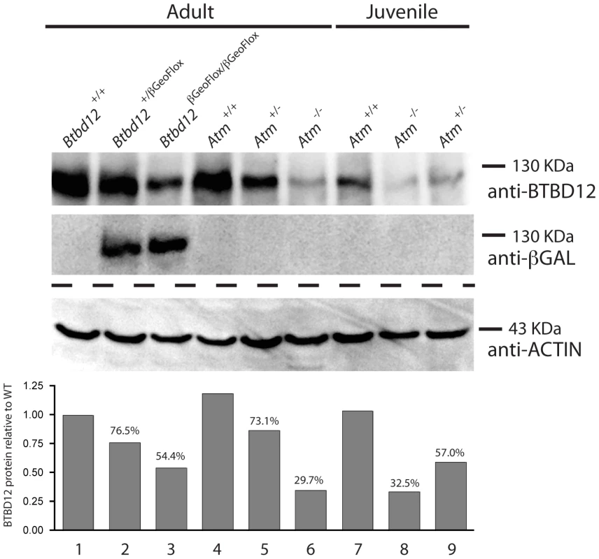 BTBD12 protein is down regulated in the <i>Btbd12<sup>βGeoFlox/βGeoFlox</sup></i> mutant and the <i>Atm</i> null mice.
