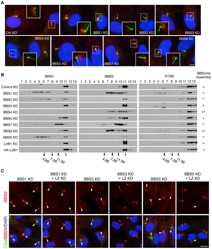 Reduction of LZTFL1 activity restores BBSome ciliary trafficking in BBS3 and BBS5 depleted cells.
