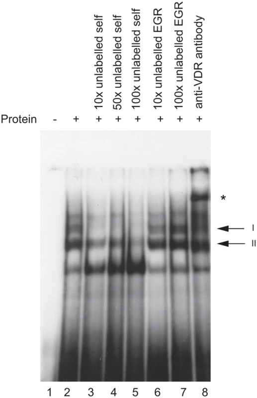 In vitro binding of VDR protein to the <i>HLA-DRB1*15</i> VDRE.