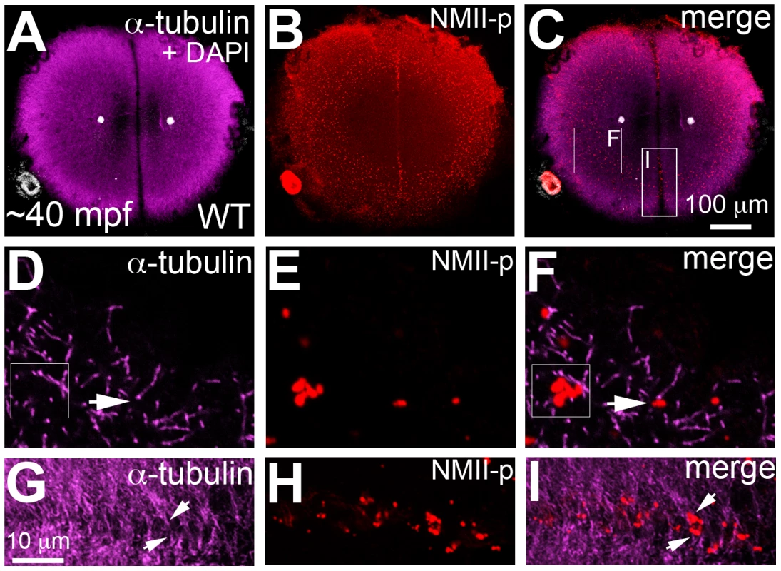 Germ plasm RNPs localize to the tips of astral microtubules.