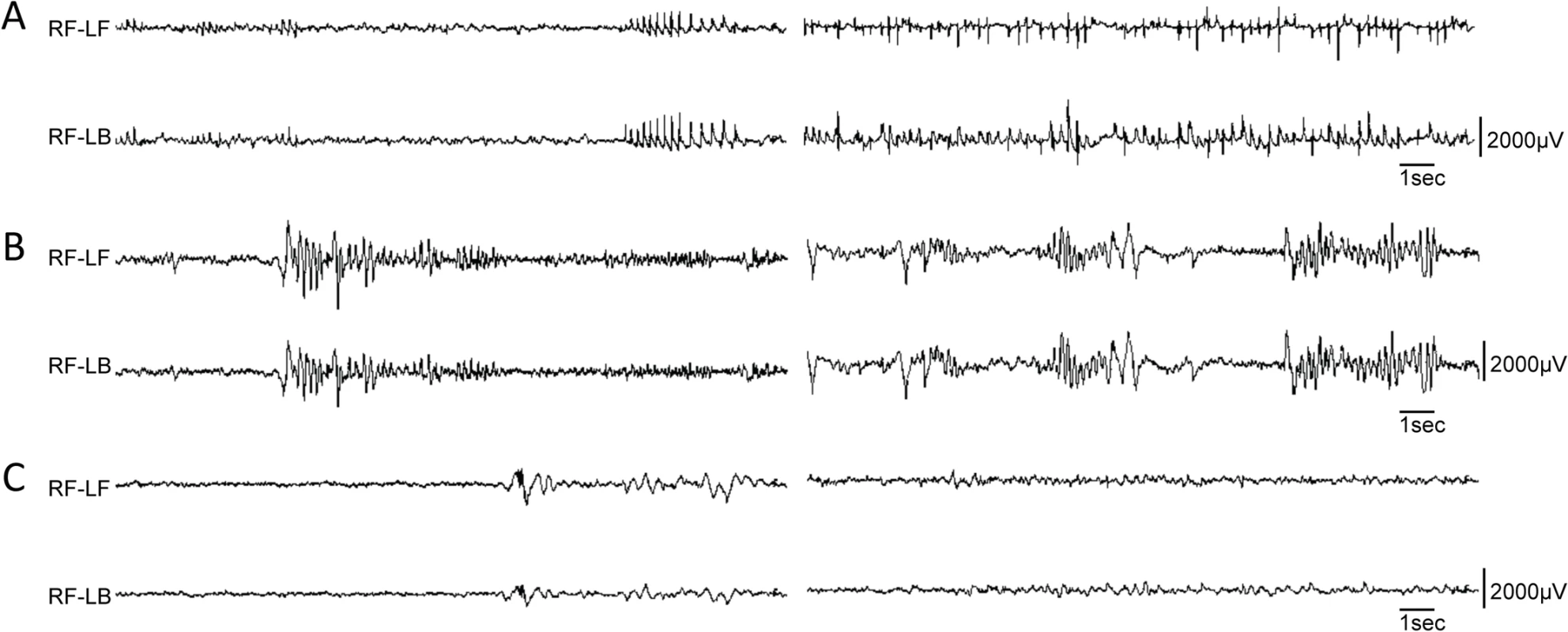 Variety of EEG seizures in different <i>Dnm1</i><sup><i>Ftfl</i></sup> conditional mutants.
