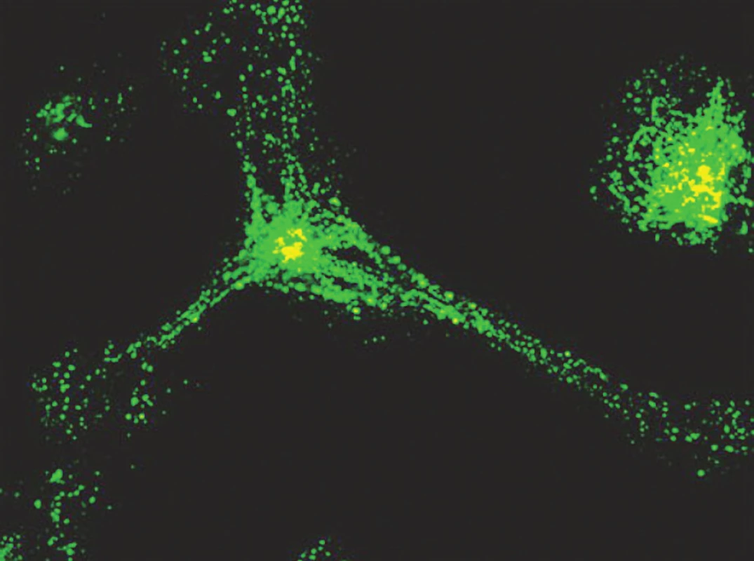 Nezralá DC pohlcuje FITC značený dextran. Po 1 h je dobře znázorněn endocytární aparát buňky a je možno pozorovat polarizaci endosomů směrem k centru mikrotubulů v blízkosti jádra
Fig. 2. Immature DCs absorb FITC- marked dextran. After 1 hour, the cellęs endocytic apparatus is well demonstrated and endosomal polarization towards the microtubular centre close to the nucleus can be observed