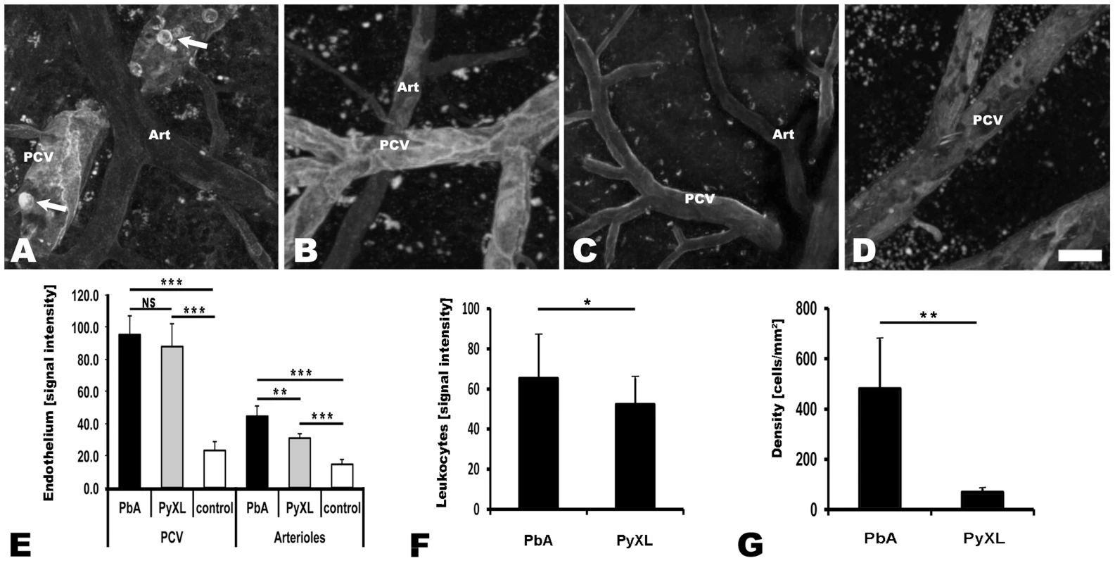 Both ECM and hyperparasitemia are associated with upregulation of endothelial ICAM-1.