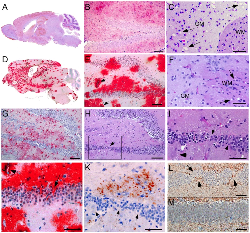 Light microscopic histopathology of scrapie-infected C57BL/10 and tg44+/+ transgenic mice.
