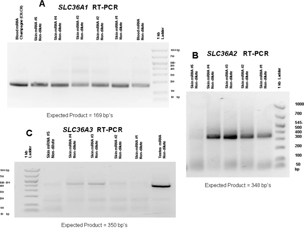 RT-PCR product results for <i>SLC36A1</i>, <i>A2</i> and <i>A3</i>.