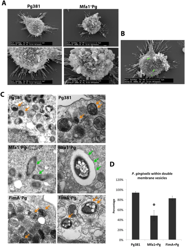 Formation of double-membrane vesicles in <i>P. gingivalis</i>-infected MoDCs.