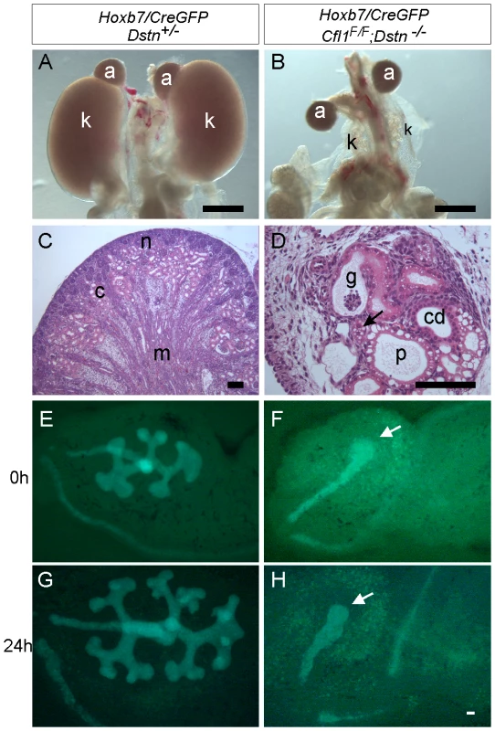 Absence of <i>Cfl1</i> and <i>Dstn</i> in the ureteric bud of embryonic kidneys results in severe renal hypodysplasia.
