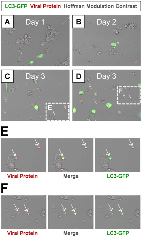 Detection of LC3 protein in shed EMVs containing viral protein.