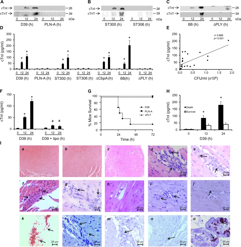 PLY-expressing but not PLY-deficient pneumococci induce cardiac injury and inflammation.