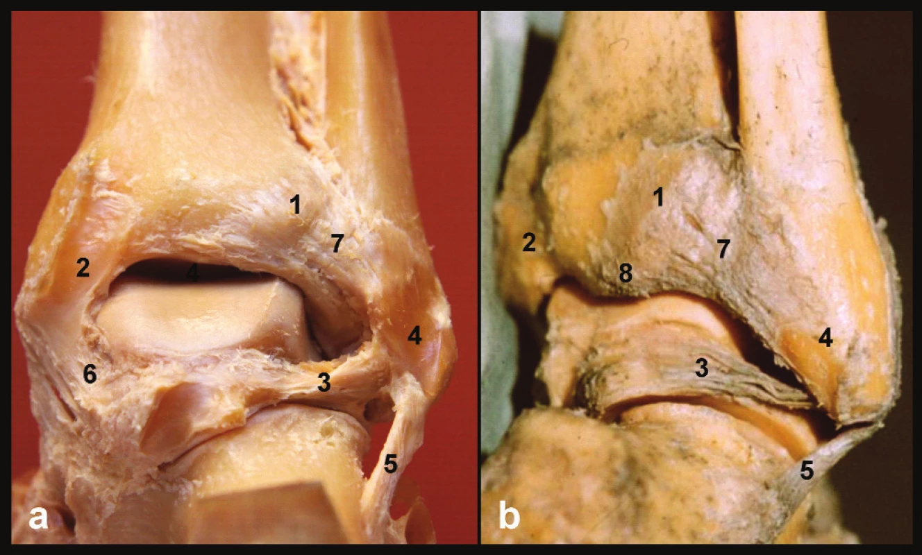Anatomie zadní hrany tibie, pravé hlezno a – pohled zezadu, b – pohled posterolaterální, 1 – tuberculum post. tibiae, 2 – sulcus tendinis m. tibialis post., 3 – lig. tibiofibulare post., 4 – sulcus malleoli lat., 5 – lig. fibulocalcaneare, 6 – tibio-talární část deltového vazu, 7 – lig. tibiofibulare post., 8 – zadní malleolus