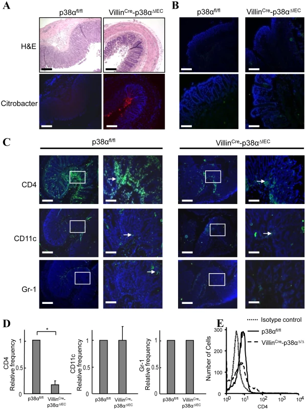 p38α in intestinal epithelial cells is required for chemokine expression and to recruit immune cells into the colon mucosa after <i>C. rodentium</i> infection.