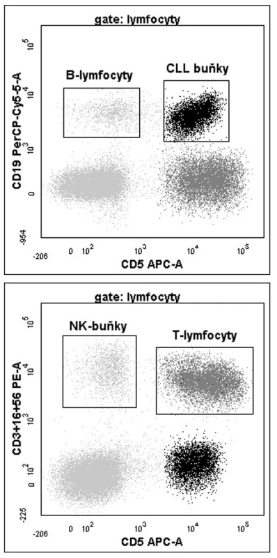 a,b. Výstupy analýzy ZAP-70 pomocí FCM. Zobrazeny jsou grafy identifikující populace CLL buněk, T-lymfocytů, NK buněk a reziduální populace normálních B-lymfocytů dle příslušných povrchových antigenů. Poměr MFI T-lymfocytů/CLL buněk je 2,6, což znamená pozitivní expresi ZAP-70 (cut-off = 4). Oproti tomu reziduální populace zdravých B-lymfocytů je pro tento znak negativní (poměr TFI T-lymfocyty/ B-lymfocyty = 6, 7).
