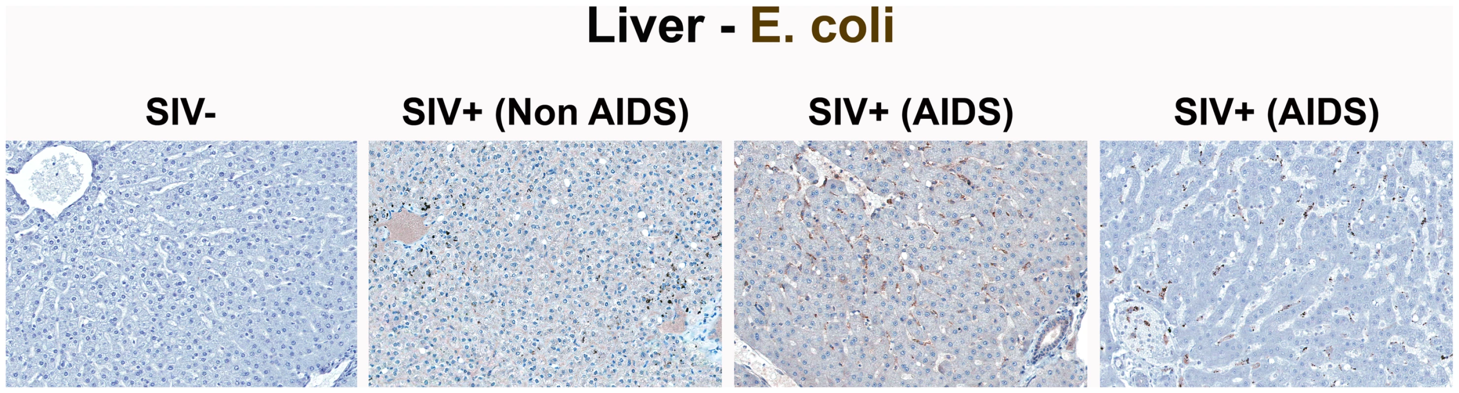 Identification of microbial translocation in the liver of chronically SIV<sup>+</sup> RMs.