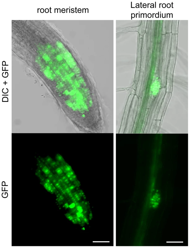 RAD51-GFP is expressed in nuclei of meristematic cells in primary and lateral roots.