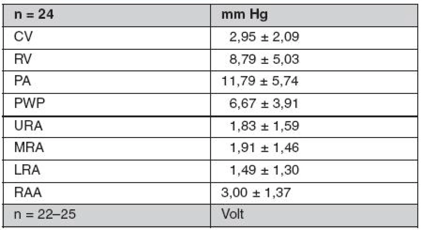 Průměrné hodnoty středních tlaků v mm Hg a elektrických potenciálů v mV při pravostranné katetrizaci a elektrofyziologii za podmínek AV dyssynchronie