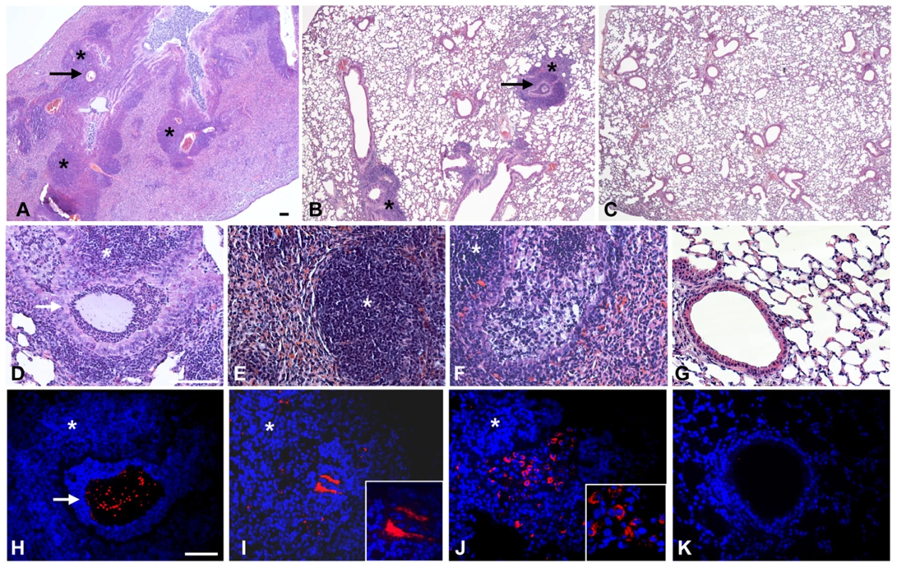 Murine lung histology and localization of <i>P. aeruginosa</i> Pos-STM mutants after 14 days.