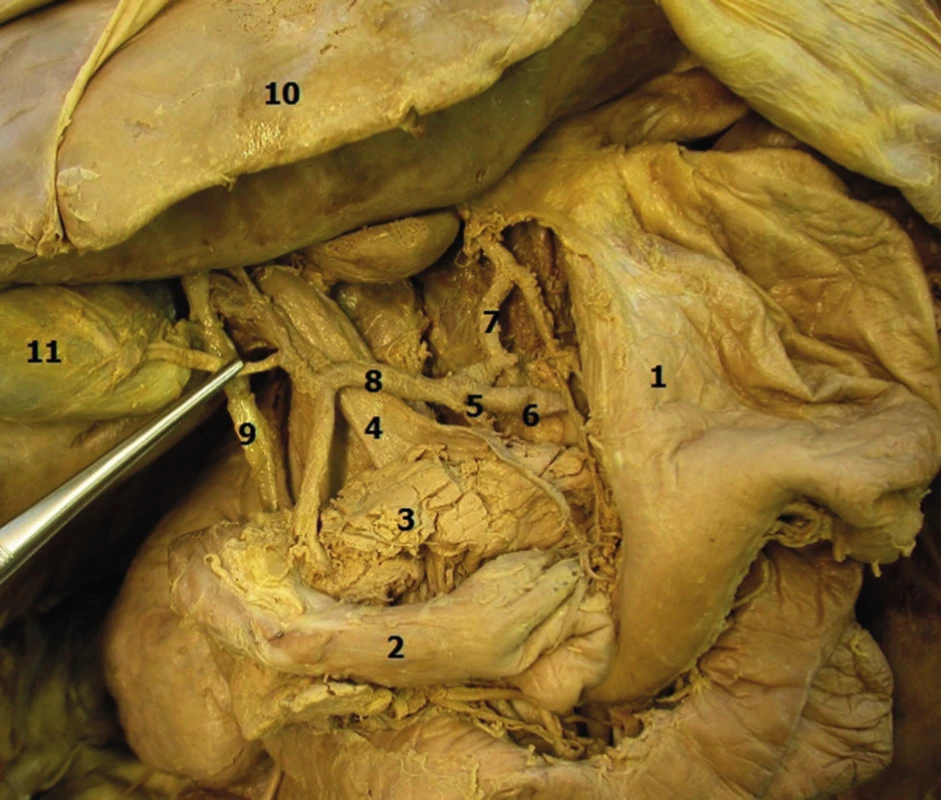 Anatomical relations in the duodenal region, distal portion of the common bile duct and head of the pancreas