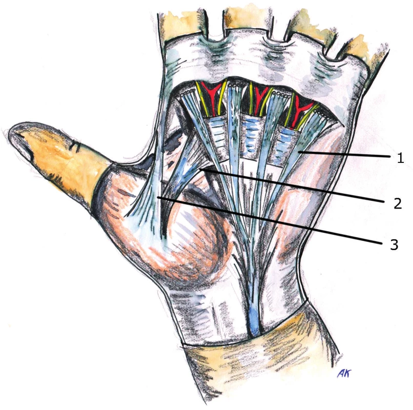 Anatomy of palmar aponeurosis
1. Longitudinal pretendinous fibers
2. Proximal commisural ligament of 1&lt;sup&gt;st&lt;/sup&gt; web space
3. Distal commisural ligament of 1&lt;sup&gt;st&lt;/sup&gt; web space