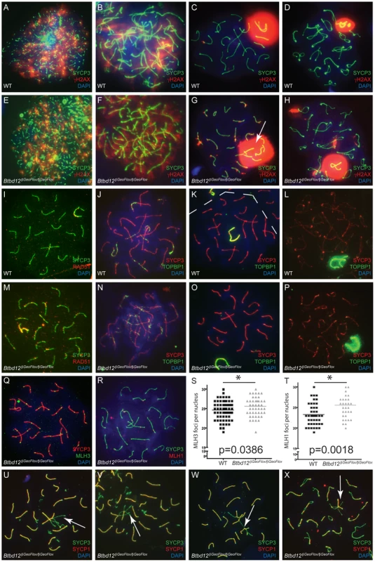 <i>Btbd12<sup>βGeoFlox/βGeoFlox</sup></i> spermatocytes show altered meiotic progression.