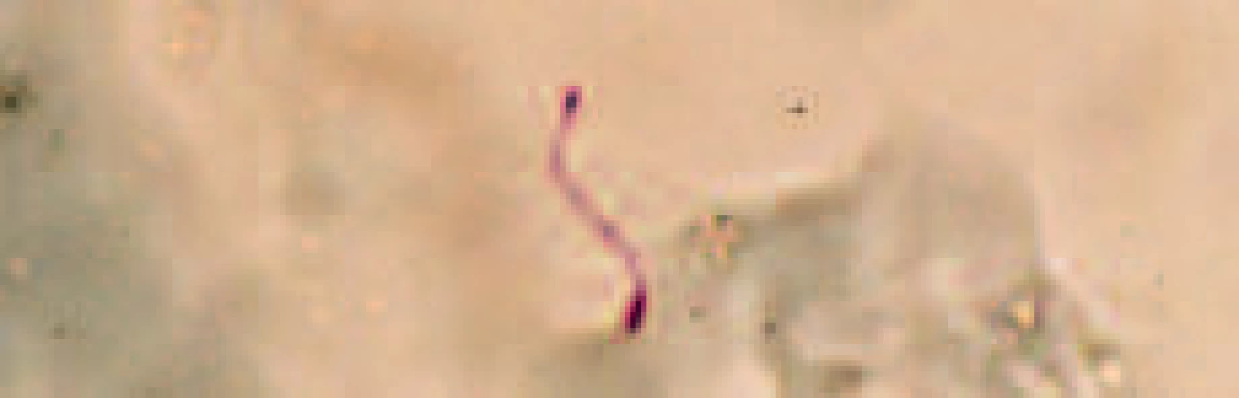 Mikroskopický průkaz M. marinum v excidované tkáni (metoda Ziehl-Neelsen, zvětšeno 650x).
