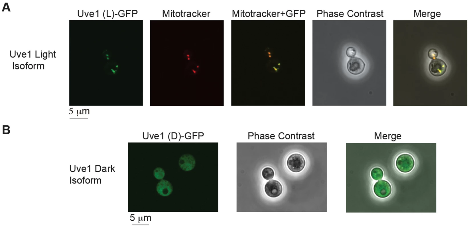 Subcellular localization of Uve1 (L)-GFP and Uve1 (D)-GFP from &lt;i&gt;C. neoformans&lt;/i&gt; var. &lt;i&gt;neoformans&lt;/i&gt; in the vegetative yeast cells of &lt;i&gt;C. neoformans&lt;/i&gt; var. &lt;i&gt;grubii&lt;/i&gt; (A) Uve1 (L)-GFP localization and (B) Uve1 (D)-GFP localization.