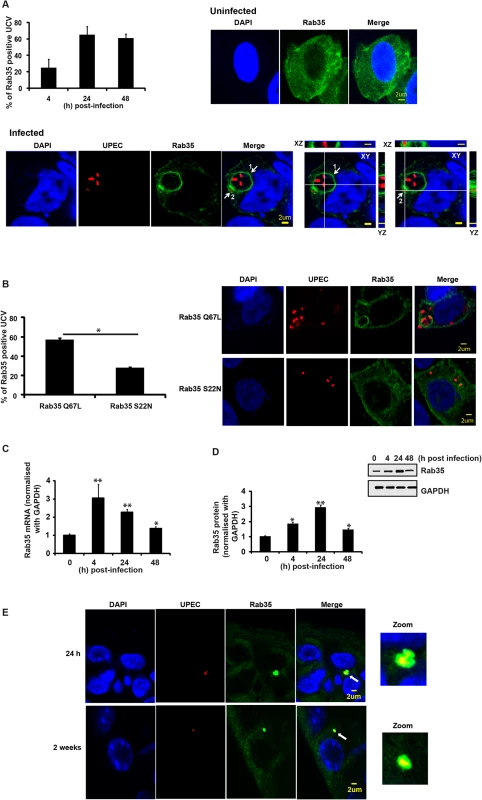 Rab35 protein localizes to UPEC-containing vacuole and is up regulated during UPEC infection.