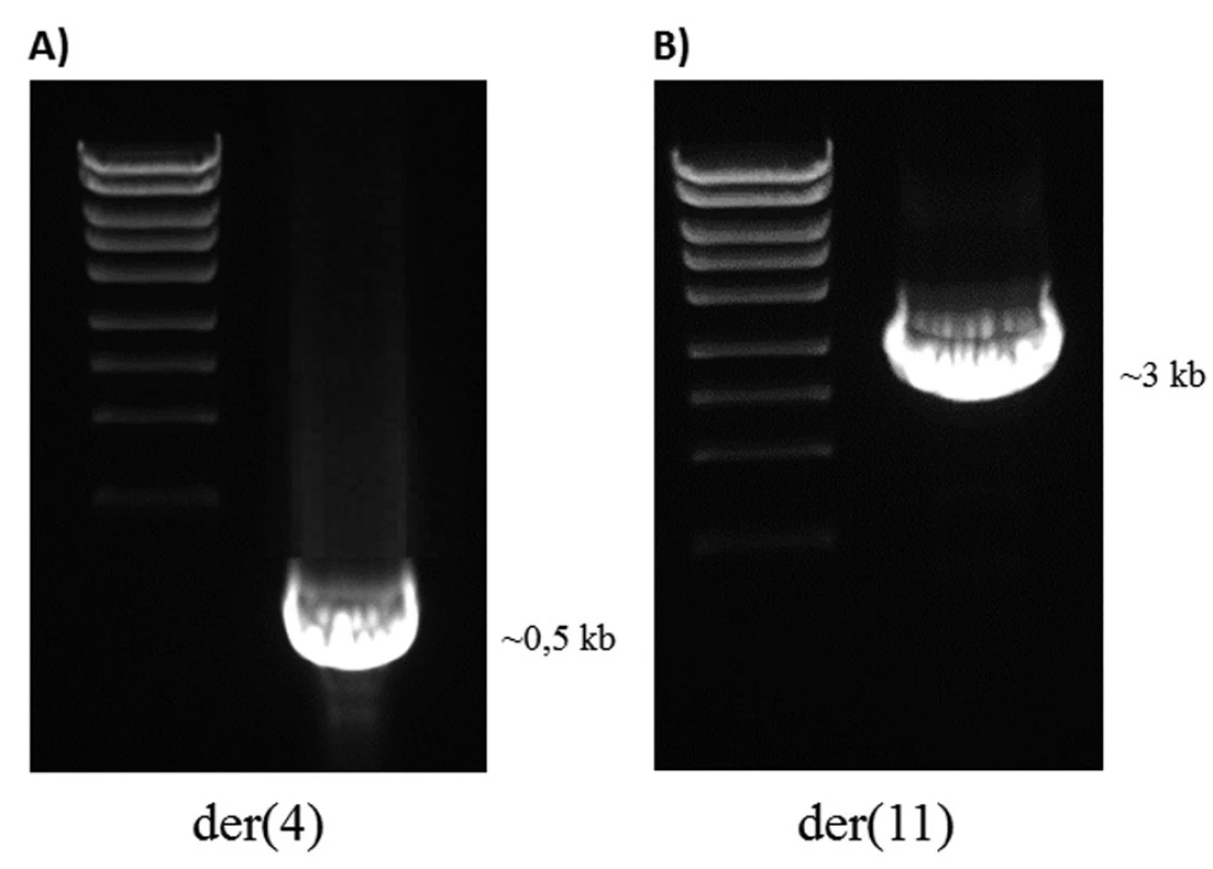 LR-PCR produkty u pacienta 2. A) Derivovaný chromozom 4. B) Derivovaný chromozom 11.