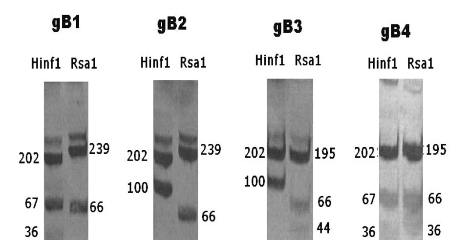 Vzorec produktů RFLP u jednotlivých genotypů gB
Fig. 1. RFLP patterns of different gB genotypes