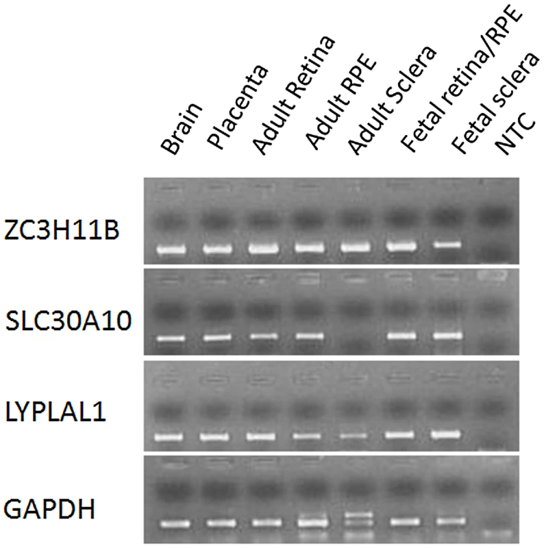mRNA expression of <i>ZC3H11B, SLC30A10</i>, and <i>LYPLAL1</i> in human tissues.