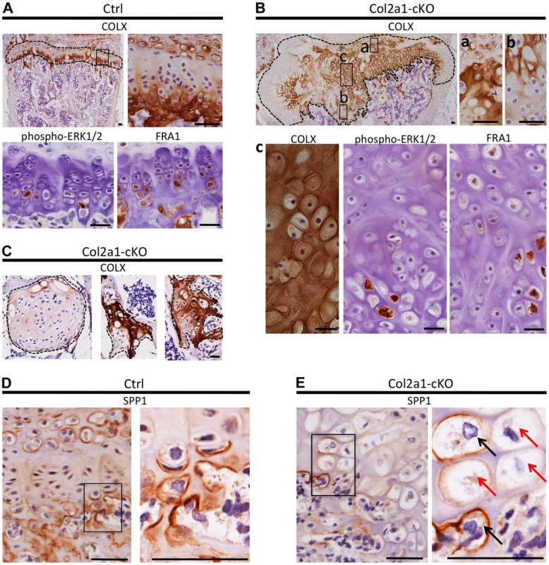 Disordered maturation zones and delayed terminal differentiation in mouse vertebral growth plates following mosaic postnatal inactivation of <i>Ptpn11</i> in chondrocytes.