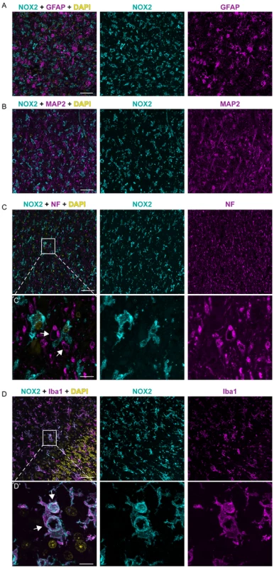 NOX2 expression is localized in microglia cells within CJD brains.